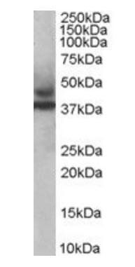 TRIM54 antibody 抗体，orb18484，Bi