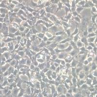 TCCSUPTCCSUP细胞细胞、TCCSUP细胞、TCCSUP细胞