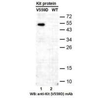 KIT(V559D)