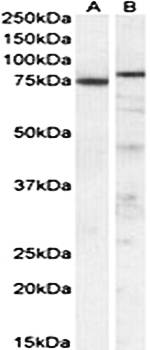 p63 antibody 抗体，orb22563，Biorb
