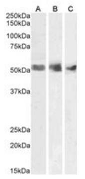 WT1 antibody 抗体，orb19311，Biorb
