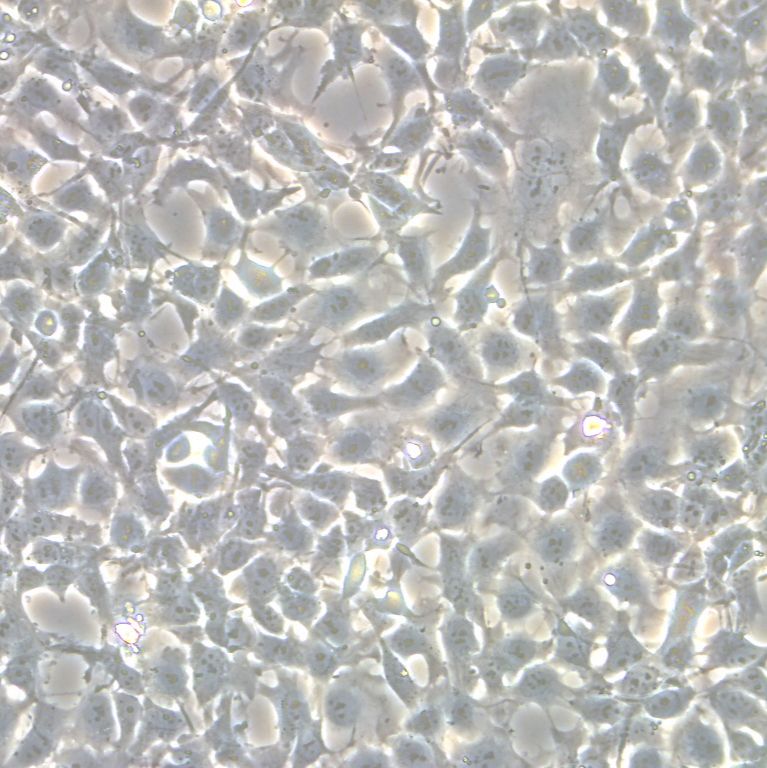 人子宫颈鳞癌细胞|SiHa人子宫颈鳞癌细胞| 人子宫颈癌细胞|SiHa人子宫颈癌细胞| SiHa细胞