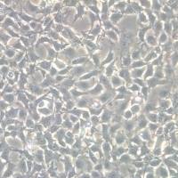  人子宫颈鳞癌细胞|SiHa人子宫颈鳞癌细胞| 人子宫颈癌细胞|SiHa人子宫颈癌细胞| SiHa细胞