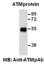 ATM Polyclonal Antibody