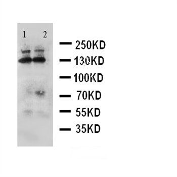 ADAMTS4/ADAMTS4 Antibody 抗体，or