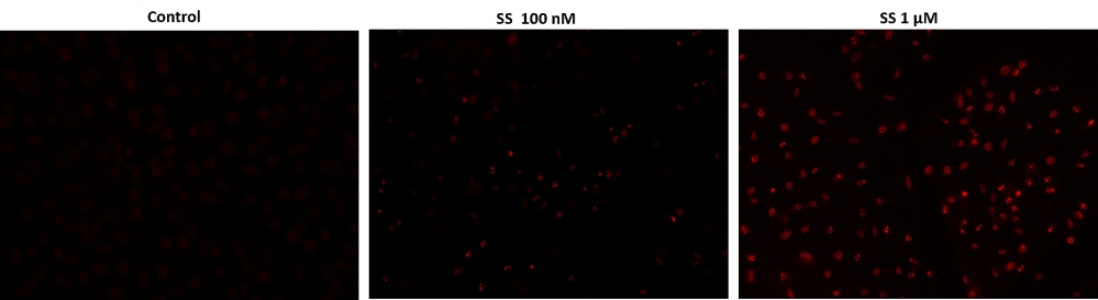 Cell Meter™TUNEL凋亡检测试剂盒