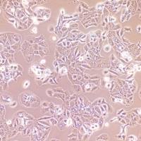 HT-1376 | HT-1376细胞 | HT1376细胞 | HT1376 | 人膀胱