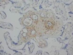 Angiopoietin 2/ANGPT2 Antibody