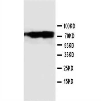Calpain 1/CAPN1 Antibody 抗体，or