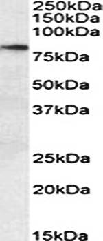 p63 antibody 抗体，orb22563，Biorb