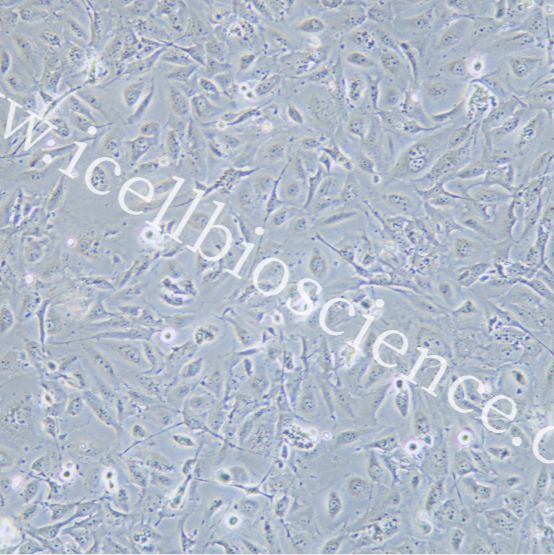NP69 |NP69细胞|NP-69|NP-69细胞|NP-69人永生化鼻咽上皮细胞/STR鉴定