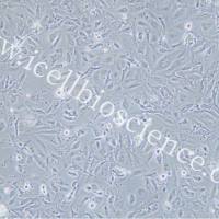 NP69 |NP69细胞|NP-69|NP-69细胞|NP-69人永生化鼻咽上皮细胞/STR鉴定