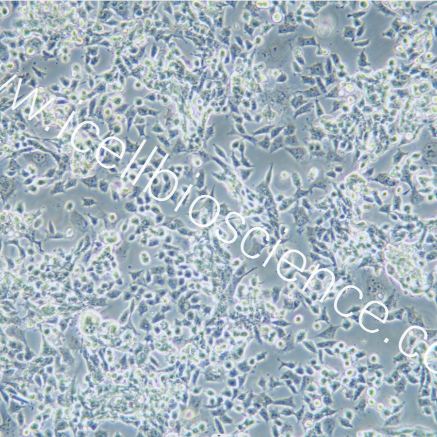 SNU-398 人肝癌细胞/STR鉴定/镜像绮点（Cellverse）