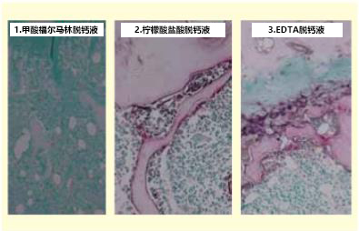 TRAP/ALP染色试剂盒，TRAP/ALP Stain K