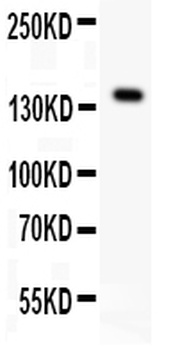 VEGF Receptor 1/FLT1 Antibody 
