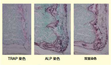 TRAP/ALP染色试剂盒，TRAP/ALP Stain K