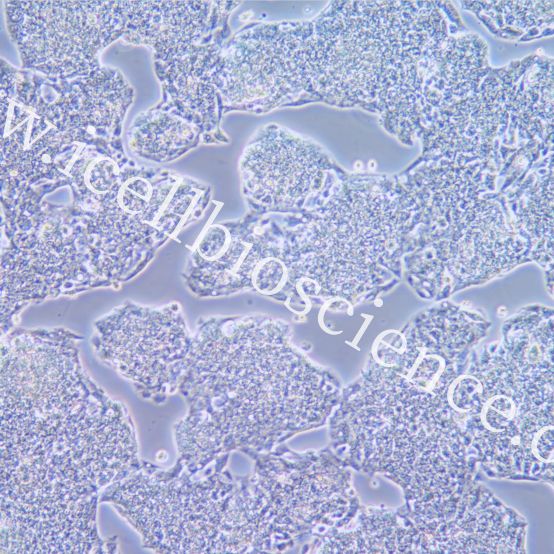Hep G2/LUC 人肝癌细胞荧光素酶标记/STR鉴定/镜像绮点（Cellverse）