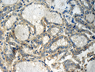 ATM Polyclonal Antibody