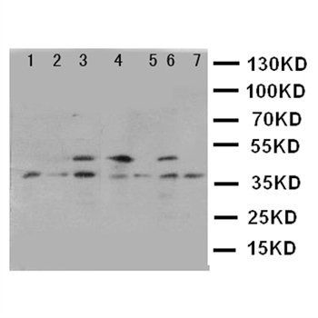 Kallikrein 11/KLK11 Antibody 抗