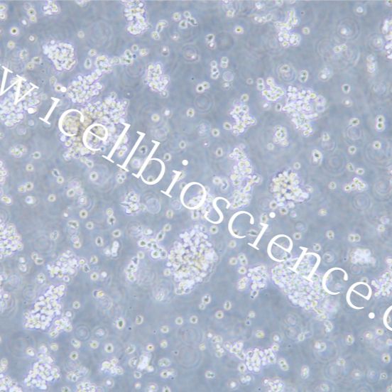 U2932 人B细胞淋巴瘤细胞/STR鉴定/镜像绮点（Cellverse）