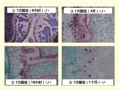 TRAP/ALP染色试剂盒，TRAP/ALP Stain K