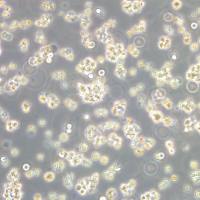 人B淋巴瘤细胞|SU-DHL-4人B淋巴瘤细胞|SU-DHL-4细胞