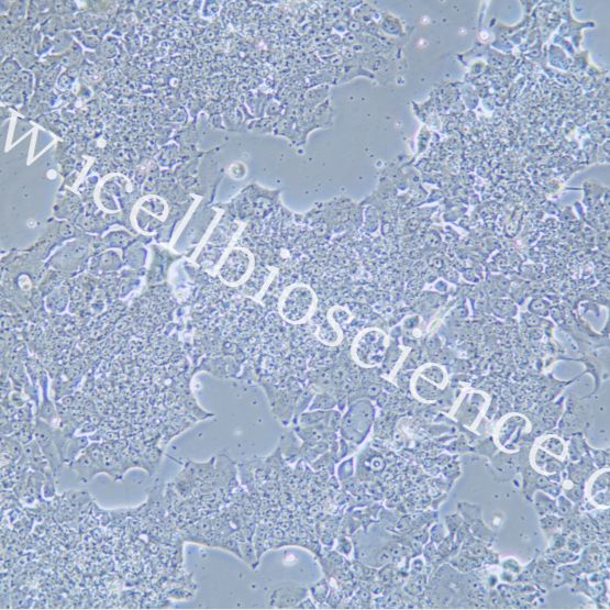 NCI-H2170 人肺癌细胞/STR鉴定/镜像绮点（Cellverse）