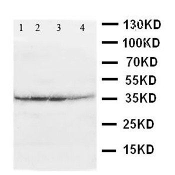 ATF4 Antibody 抗体，orb48004，Bior