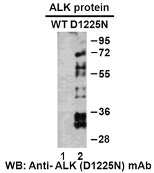 ALK (D1225N)
