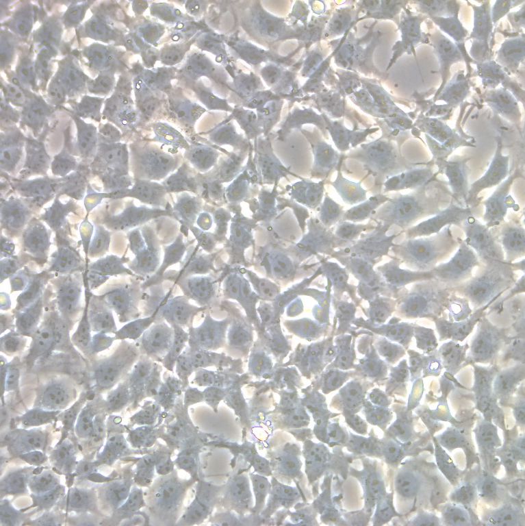 人骨肉瘤细胞|U-2 OS人骨肉瘤细胞|U-2 OS细胞