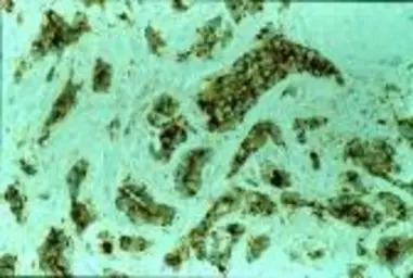 MVP/LRP antibody [1032]