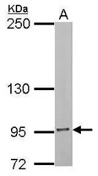 Insulin Receptor antibody