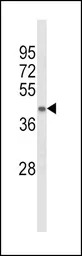 ACADL antibody, Internal