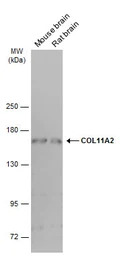 COL11A2 antibody [GT6410]