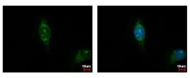 Casein Kinase 1 alpha 1L antib