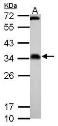 FHL2 antibody