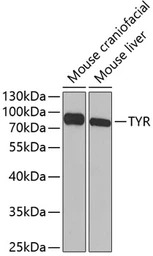 Tyrosinase antibody
