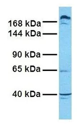 ABCC9 antibody, Internal