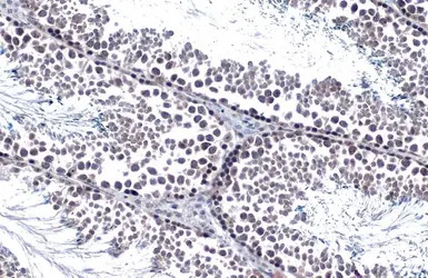 Androgen Receptor antibody [N1