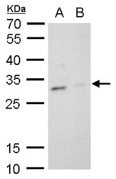 TPPP antibody [N1C3]