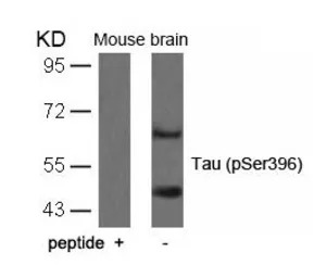 Tau (phospho Ser396) antibody