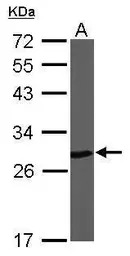 PGP9.5 antibody
