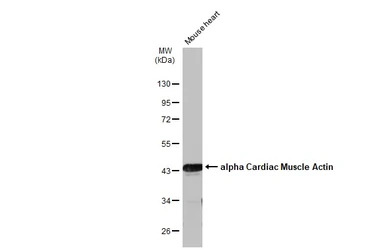 alpha Cardiac Muscle Actin ant