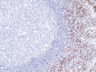 Cyclin D1 antibody [RM241]