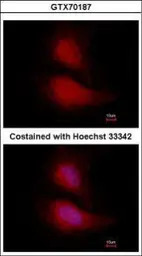 FOXO1 antibody [14E4]