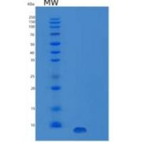 人胰岛素样生长因子I/IGF-I/胰岛素样生长因子1（4-70）重组蛋白