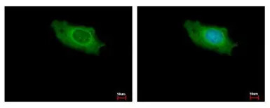 IKAP antibody [C1C2], Internal