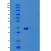 人激活B7-1抗原重组蛋白