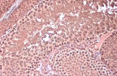 Homeobox C10 antibody