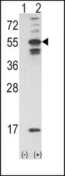 CaMKII alpha antibody, C-term